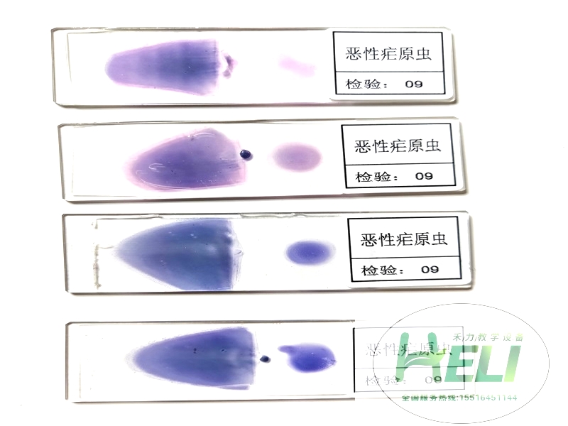 寄生虫类玻片-恶性疟原虫涂片